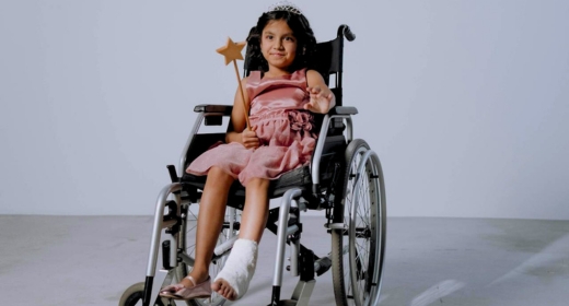 best treatment for Clubfoot in Hyderabad